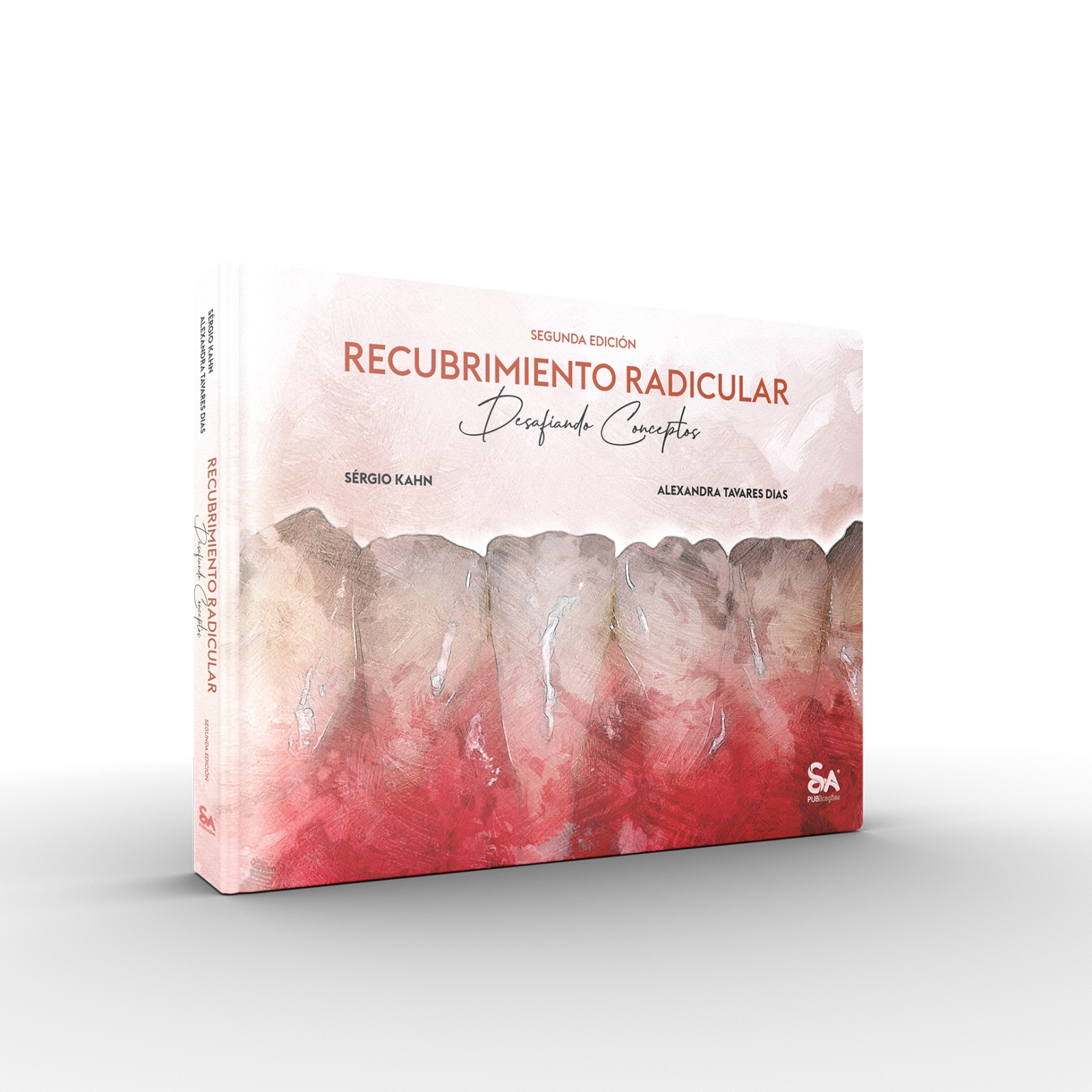 Recubrimiento Radicular – Desafiando Conceptos - Ed Espanhol