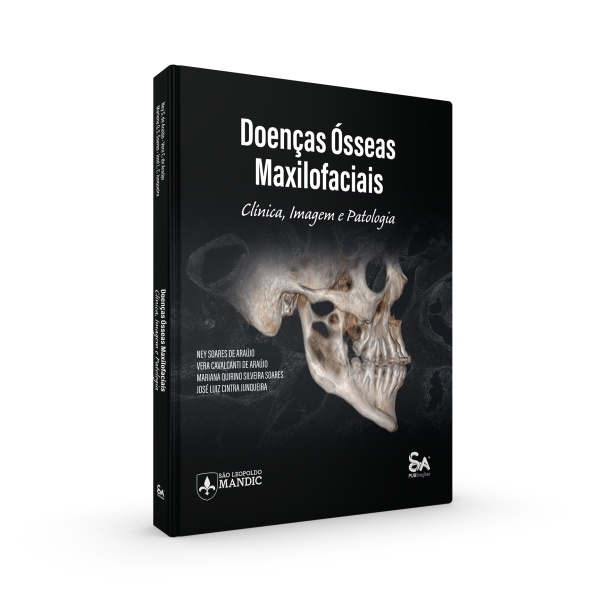 Doenças Ósseas Maxilofaciais: Clínica, Imagem e Patologia